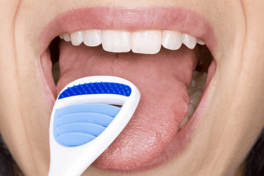 Tongue Scrapper